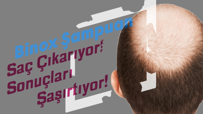 Binox Saç Çıkaran Şampuan ve Serum Ne İşe Yarar?